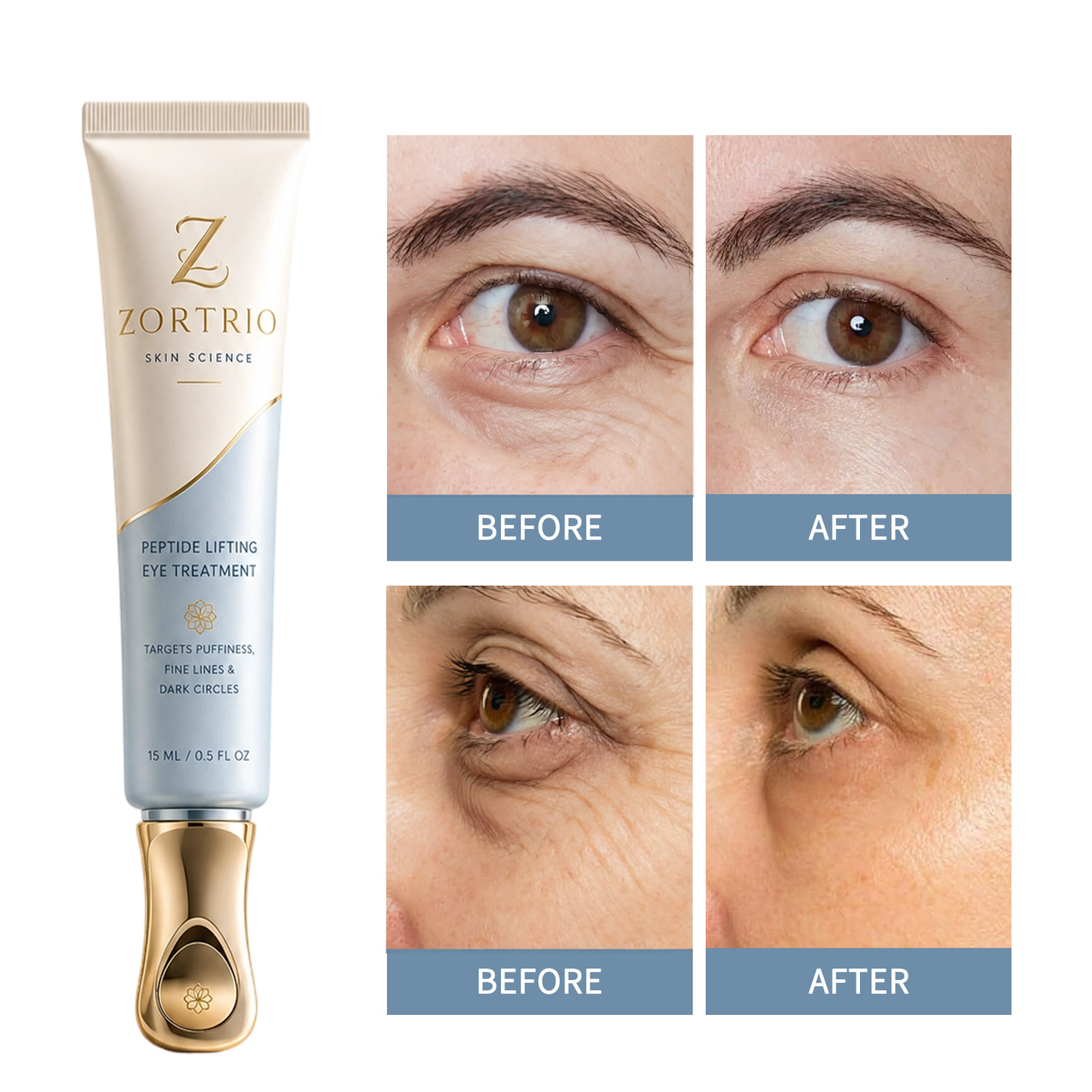 ZORTRIO™ Instant Face Temporary Tightener – Instant visible results in 30 seconds