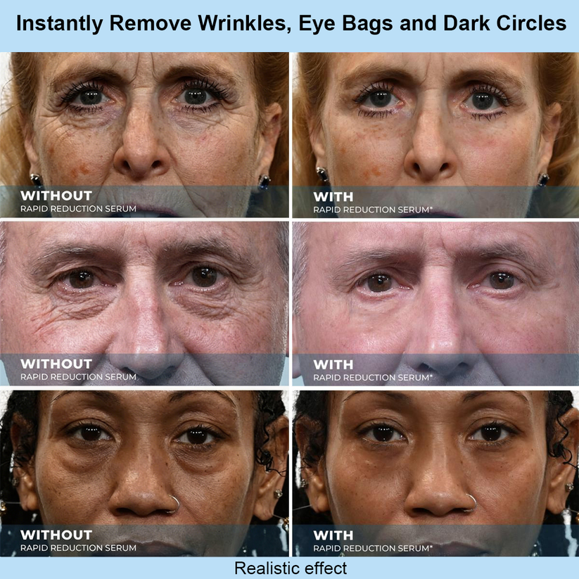 ZORTRIO™ Instant Face Temporary Tightener – Instant visible results in 30 seconds